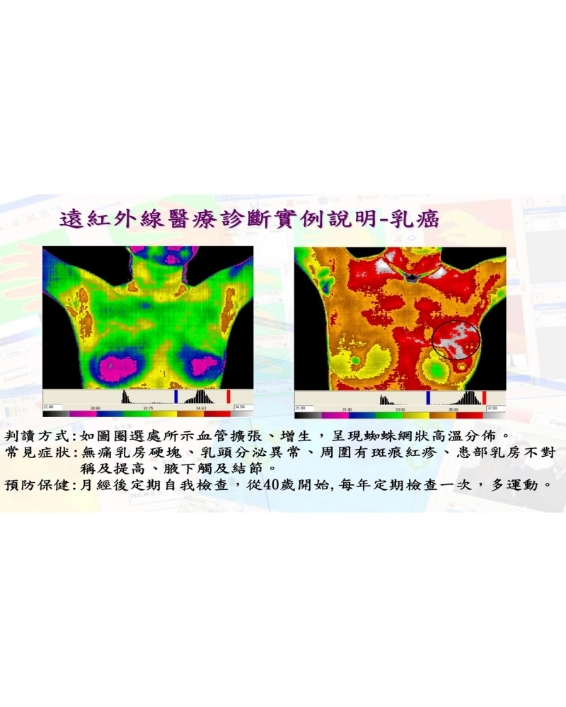 投影片32